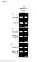 Fig. 06 - PHANTOM PHENOMENA TREATMENT