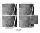 Fig. 22 - Autoassembling peptides for the treatment of pulmonary bulla