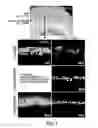 Fig. 05 - Method of administering MANF for the protection of sensory cells