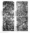 Fig. 29 - Methods of diagnosing and treating complications of pregnancy