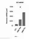 Fig. 11 - METHODS AND COMPOSITIONS FOR THE TREATMENT OF GLAUCOMA