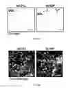 Fig. 18 - METHODS AND COMPOSITIONS FOR THE TREATMENT OF GLAUCOMA