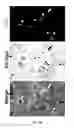Fig. 19 - METHODS AND COMPOSITIONS FOR THE TREATMENT OF GLAUCOMA