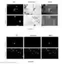 Fig. 21 - METHODS AND COMPOSITIONS FOR THE TREATMENT OF GLAUCOMA