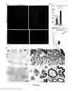 Fig. 04 - Compositions and methods of treating root avulsion injury