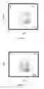 Fig. 07 - A Composition Comprising Ex-Vivo Generated Dendritic Cells