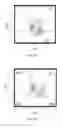 Fig. 08 - A Composition Comprising Ex-Vivo Generated Dendritic Cells