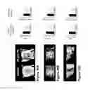 Fig. 37 - Compositions and methods for controlled localized delivery of bone forming therapeutic agents
