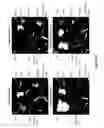 Fig. 42 - Compositions and methods for controlled localized delivery of bone forming therapeutic agents