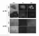 Fig. 06 - PH SENSITIVE FLUORESCENT COMPOUNDS AND METHODS FOR TUMOR DETECTION