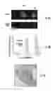 Fig. 10 - PH SENSITIVE FLUORESCENT COMPOUNDS AND METHODS FOR TUMOR DETECTION