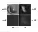 Fig. 11 - PH SENSITIVE FLUORESCENT COMPOUNDS AND METHODS FOR TUMOR DETECTION