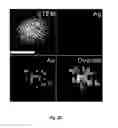 Fig. 05 - Methods and systems for noninvasive fluorescence-based functional imaging of kidneys