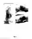 Fig. 06 - Methods and systems for noninvasive fluorescence-based functional imaging of kidneys