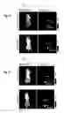 Fig. 07 - Methods and systems for noninvasive fluorescence-based functional imaging of kidneys