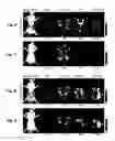 Fig. 08 - Methods and systems for noninvasive fluorescence-based functional imaging of kidneys