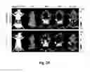 Fig. 18 - Methods and systems for noninvasive fluorescence-based functional imaging of kidneys