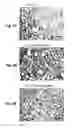 Fig. 28 - Methods and systems for noninvasive fluorescence-based functional imaging of kidneys