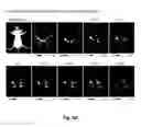Fig. 31 - Methods and systems for noninvasive fluorescence-based functional imaging of kidneys