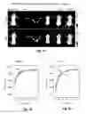 Fig. 32 - Methods and systems for noninvasive fluorescence-based functional imaging of kidneys