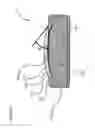 Fig. 06 - IMPLANTABLE CELL ENCAPSULATION DEVICE