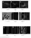 Fig. 04 - Tissue substitute multilayer matrix and uses thereof