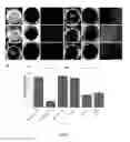 Fig. 05 - INJECTABLE CHITOSAN SPONGES FOR ENHANCING BONE REGENERATION