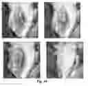 Fig. 02 - Method for decellularization of tissue