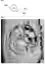 Fig. 07 - Method for controlling work time for forming shape of biphasic self-setting calcium phosphate