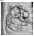 Fig. 08 - Method for controlling work time for forming shape of biphasic self-setting calcium phosphate