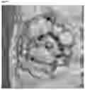 Fig. 09 - Method for controlling work time for forming shape of biphasic self-setting calcium phosphate