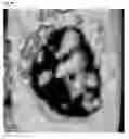 Fig. 16 - Method for controlling work time for forming shape of biphasic self-setting calcium phosphate