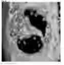 Fig. 37 - Method for controlling work time for forming shape of biphasic self-setting calcium phosphate