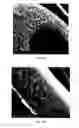 Fig. 33 - Crystalline coating and release of bioactive agents