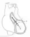 Fig. 01 - Motor assembly for catheter pump