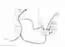 Fig. 01 - Method and apparatus for mitigating acute reoxygenation injury during percutaneous coronary intervention