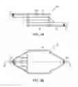 Fig. 04 - Magnetic filter apparatus and method