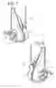 Fig. 06 - Infusion pump including syringe sensing