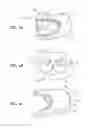 Fig. 16 - Patient interface and aspects thereof