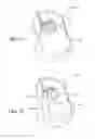 Fig. 40 - Patient interface and aspects thereof
