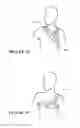 Fig. 48 - Patient interface and aspects thereof