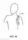 Fig. 49 - Patient interface and aspects thereof