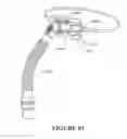 Fig. 64 - Patient interface and aspects thereof