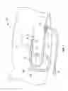 Fig. 02 - Sheath retainer devices, systems and methods