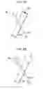 Fig. 06 - Catheter