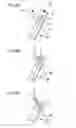 Fig. 09 - Catheter