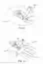 Fig. 07 - GRAPHIC FOR MEDICAL ARTICLE SECUREMENT SYSTEMS AND METHODS OF USING SAME