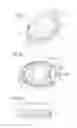 Fig. 02 - Port for a catheter