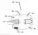 Fig. 01 - INFLATABLE TRANSLUMENAL SHUNTS AND METHODS AND DEVICES FOR DELIVERY