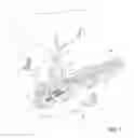 Fig. 02 - INFLATABLE TRANSLUMENAL SHUNTS AND METHODS AND DEVICES FOR DELIVERY